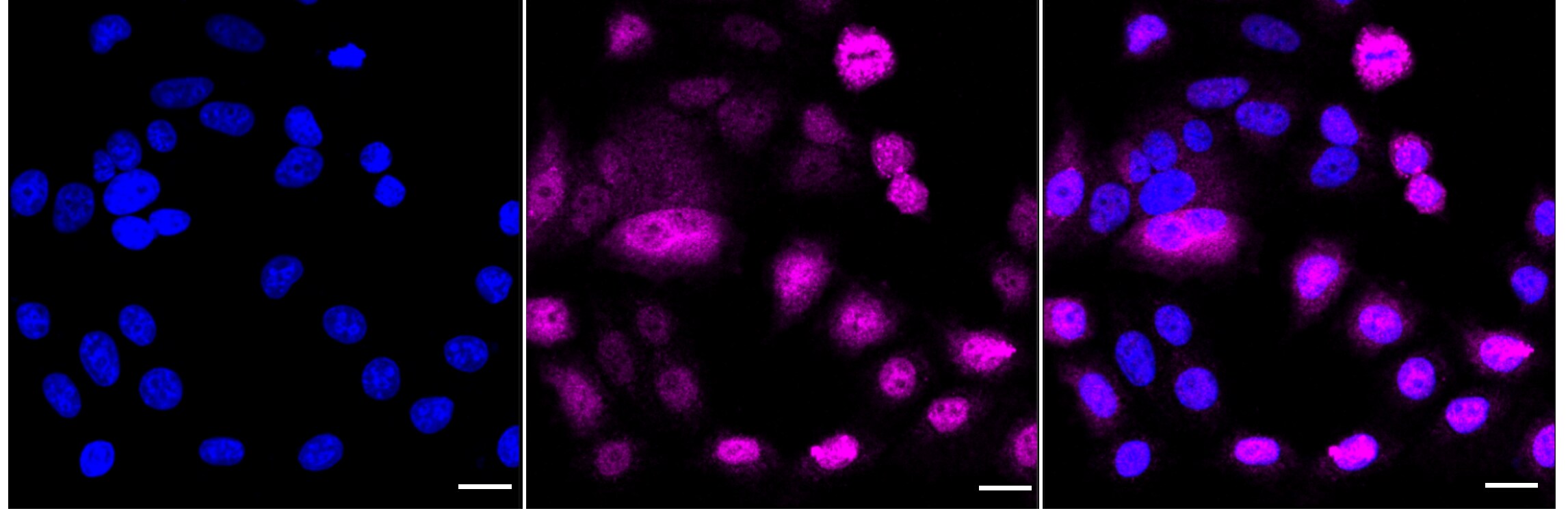 NFkB2/NFkB p100 Antibody (24GB3505)