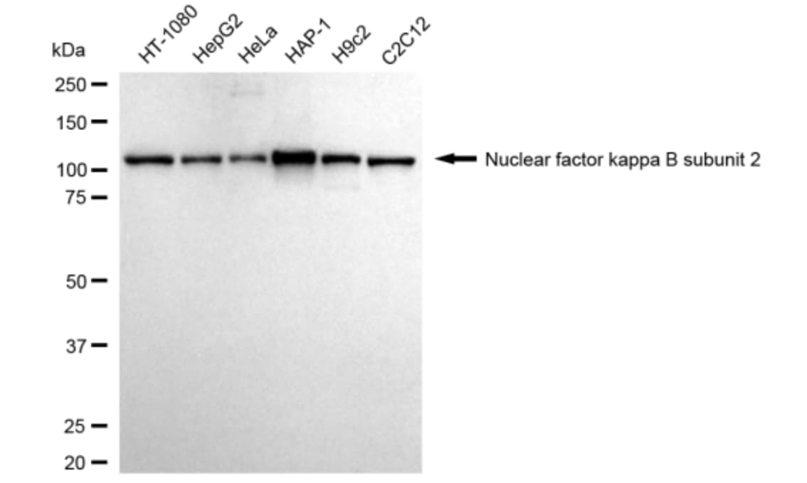 NFkB2/NFkB p100 Antibody (24GB3505)