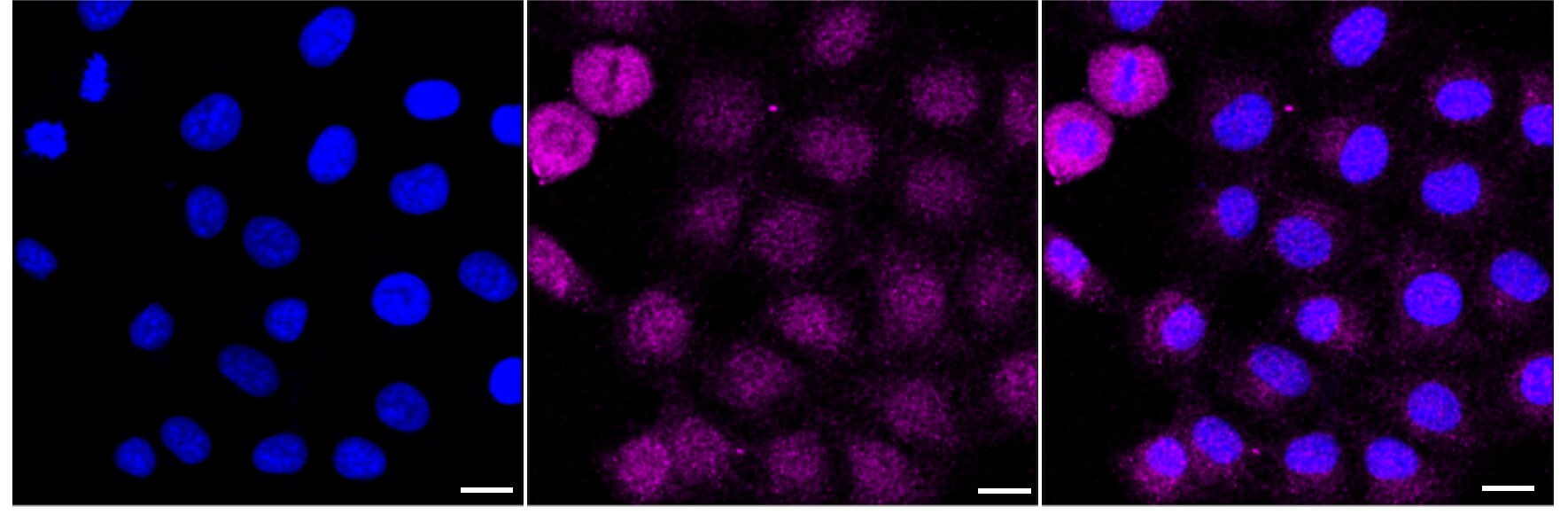 DCTN5 Antibody (24GB3540)