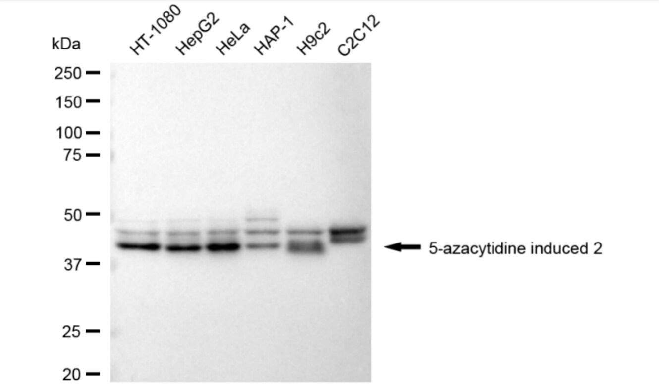 AZI2 Antibody (24GB3555)