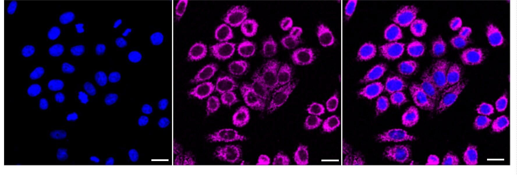NDUFB8 Antibody (24GB3625)