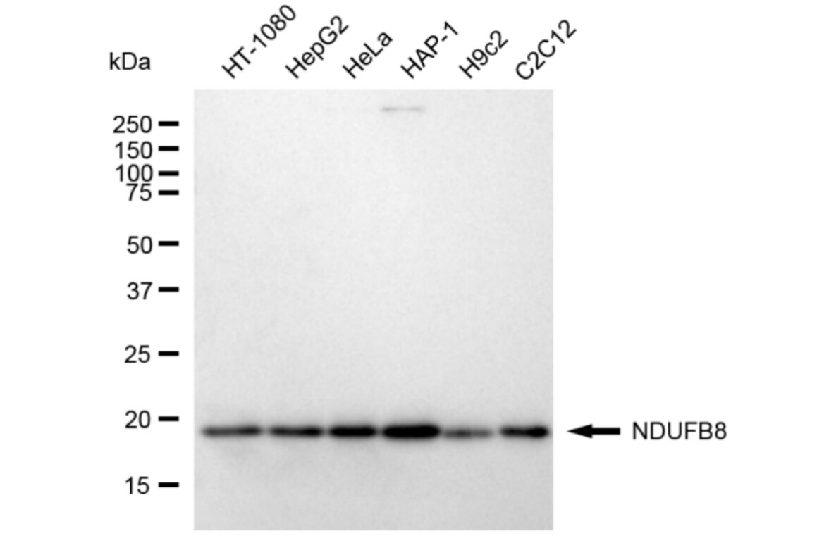 NDUFB8 Antibody (24GB3625)