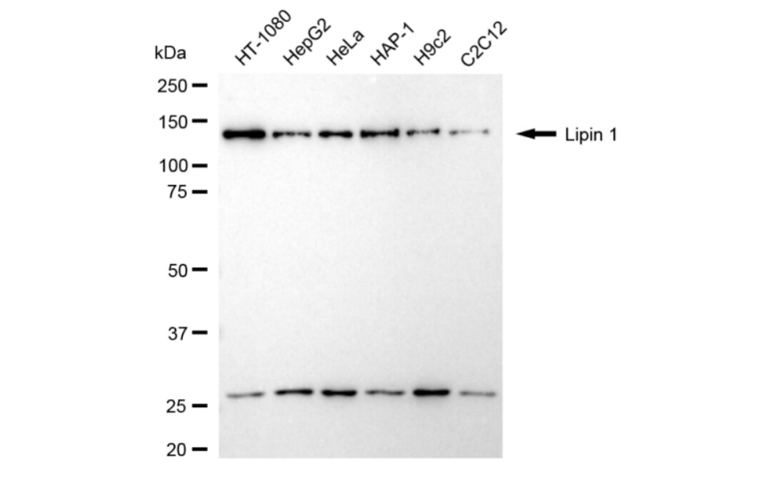 Lipin 1 Antibody (24GB3665)