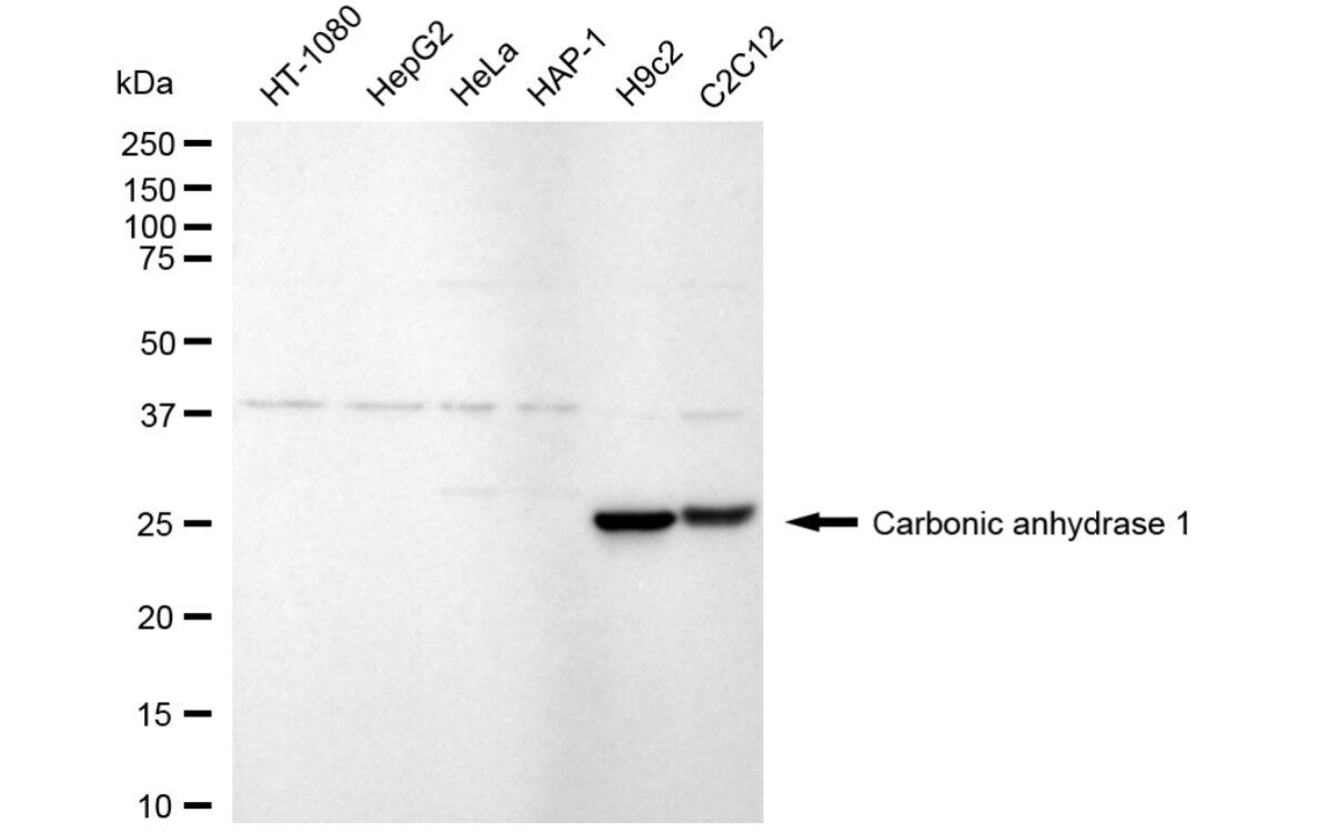 Carbonic Anhydrase I/CA1 Antibody (24GB3680)