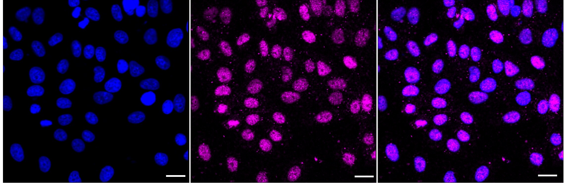 Glutamate Receptor 6 Antibody (24GB3695)