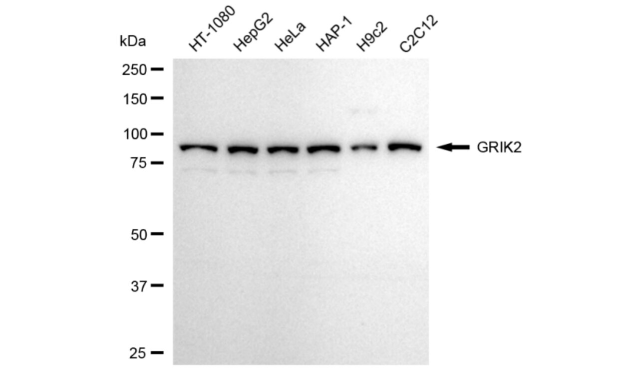 Glutamate Receptor 6 Antibody (24GB3695)