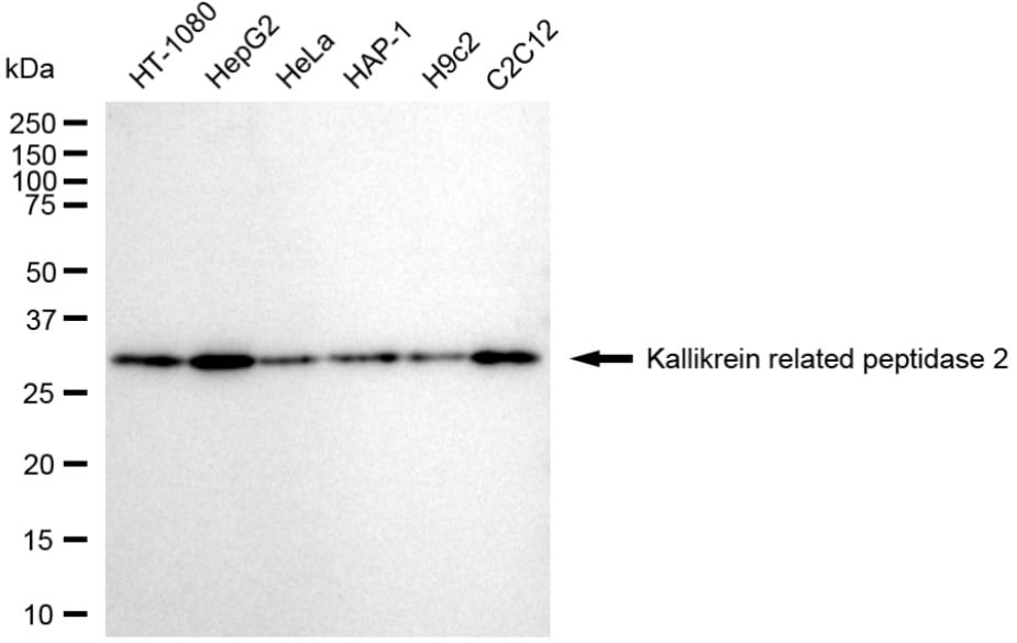 Kallikrein 2 Antibody (24GB3700)