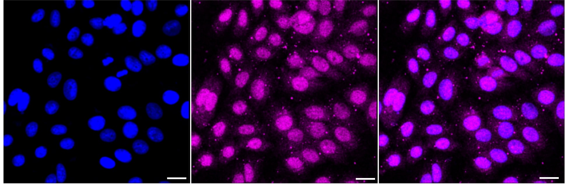 NM23-H2/NME2 Antibody (24GB3730)