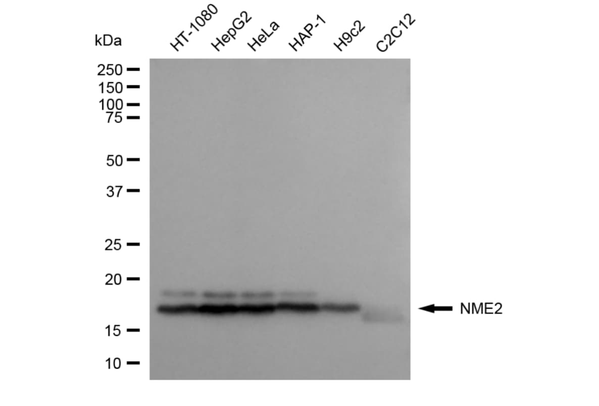 NM23-H2/NME2 Antibody (24GB3730)