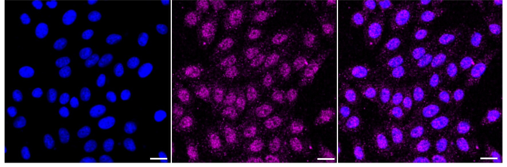 GSTO1 Antibody (24GB3735)