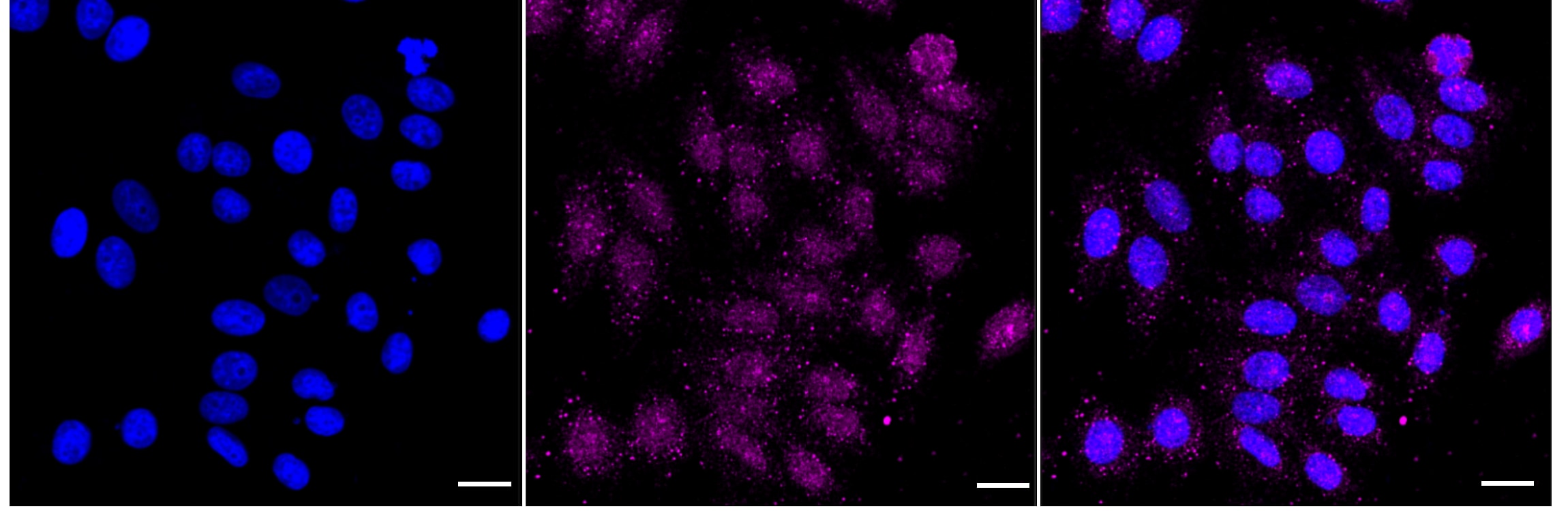 ACADM Antibody (24GB3800)