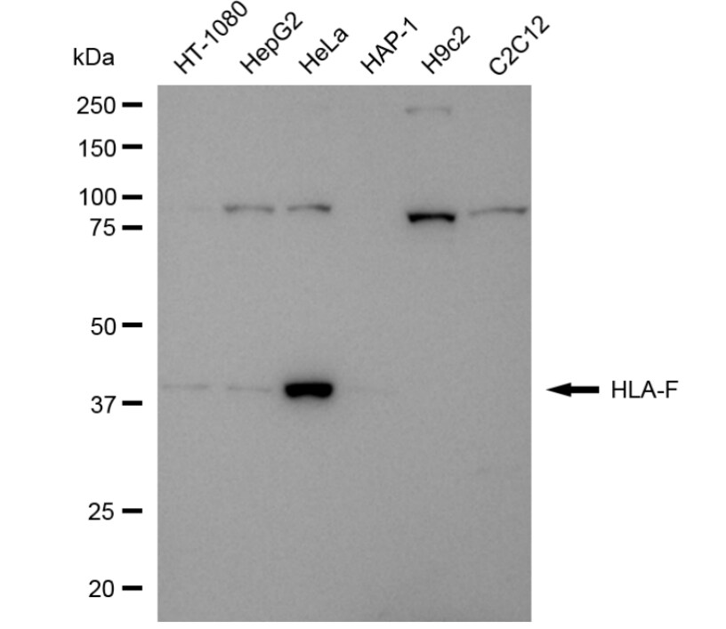 HLA F Antibody (24GB3830)