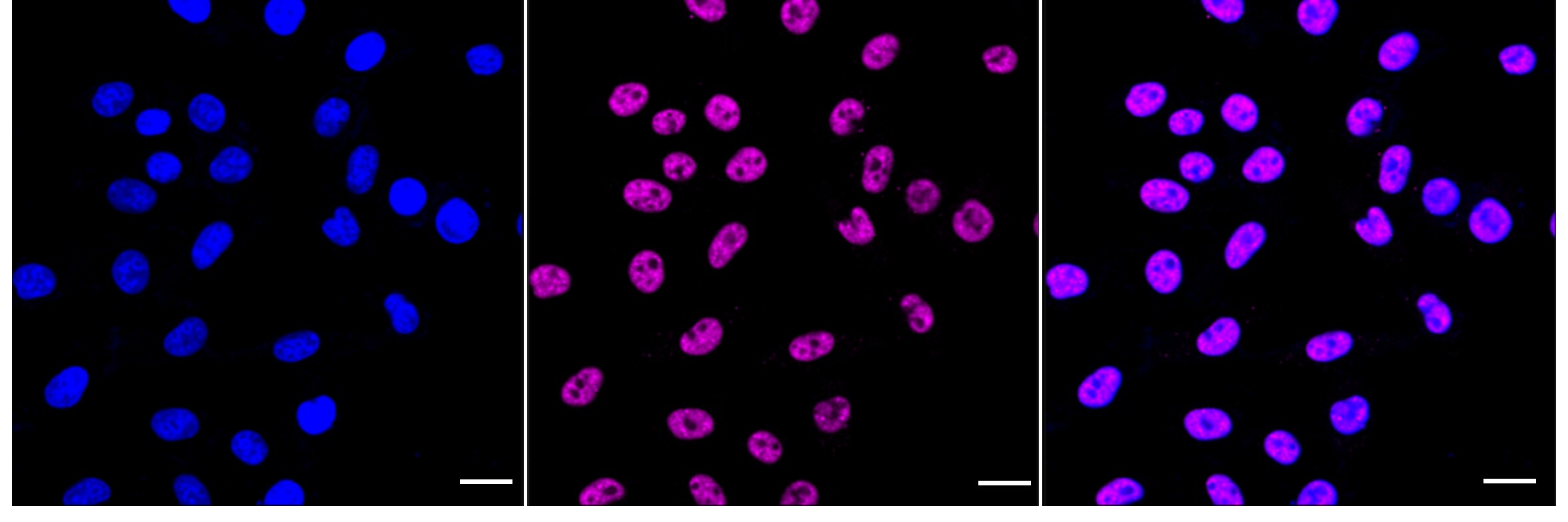 SNRPA1 Antibody (24GB3855)