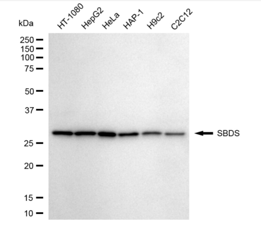 Ribosome maturation protein SBDS Antibody (24GB3860)