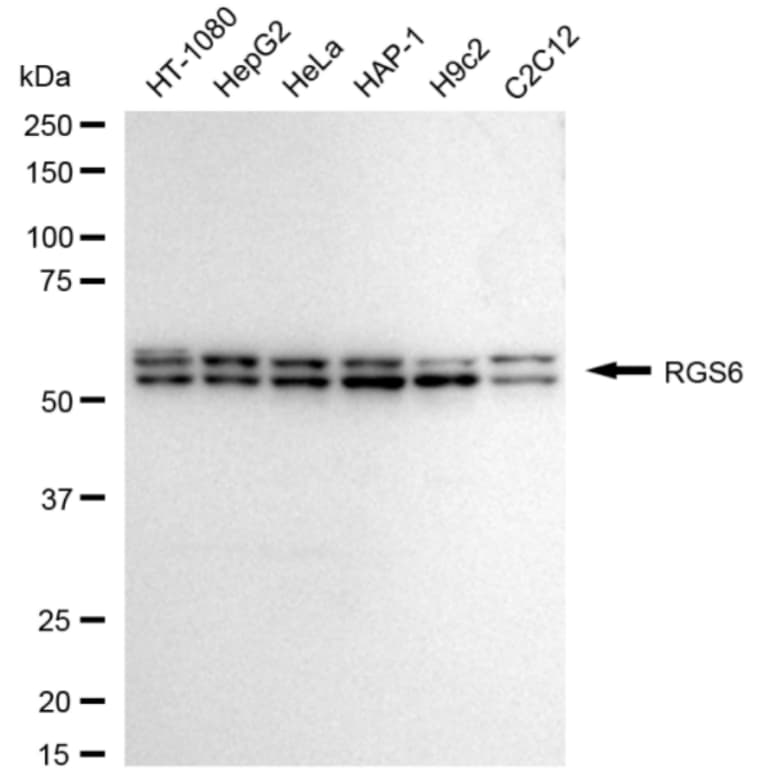 RGS6 Antibody (24GB3885)