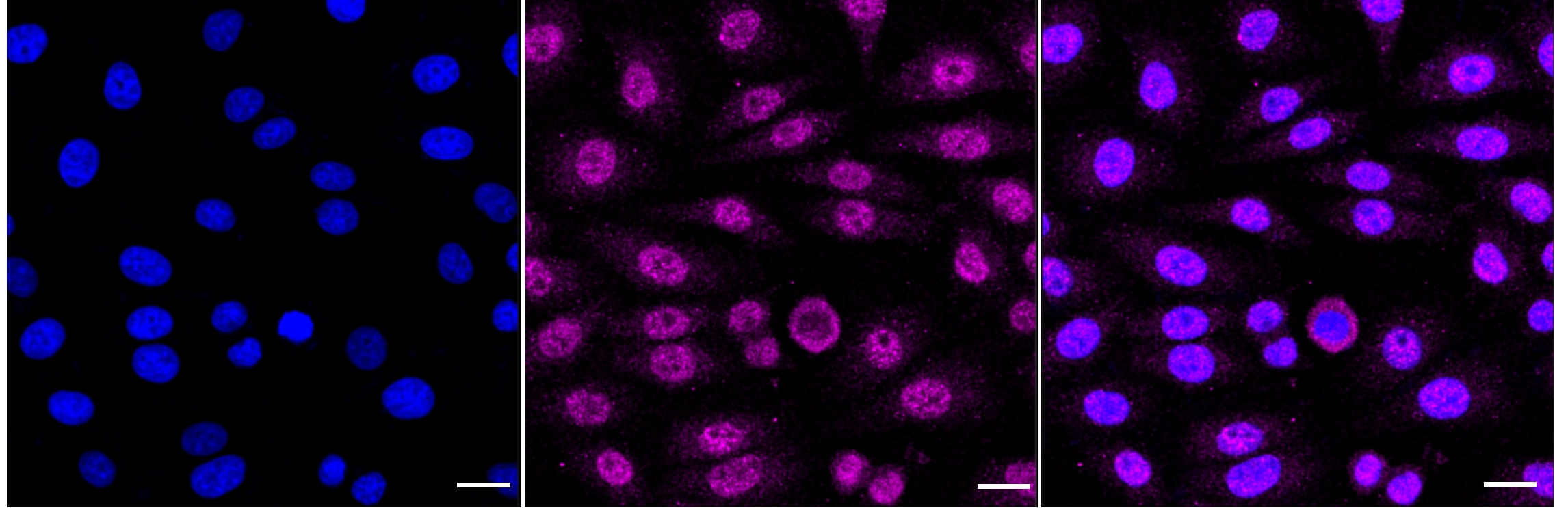 EGLN2/PHD1 Antibody (24GB3910)
