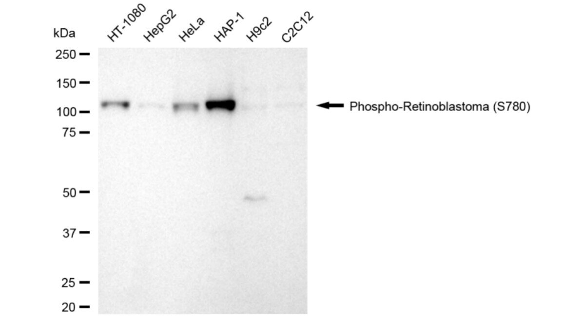 RB1 [p Ser780] Antibody (24GB3950)