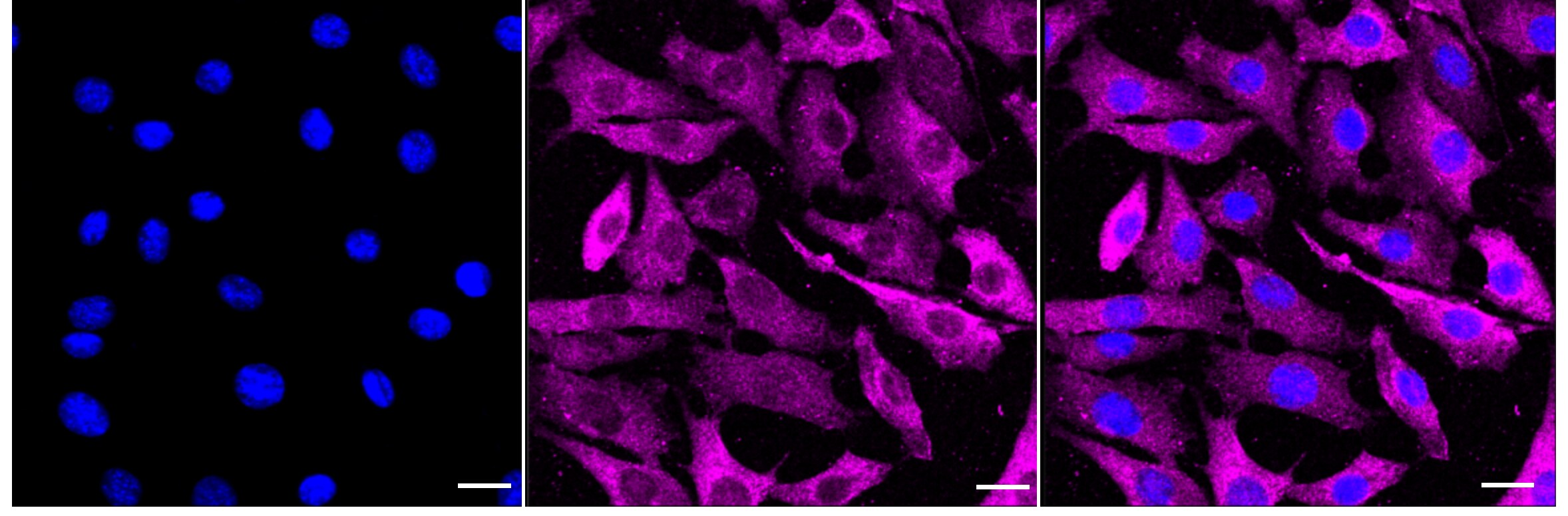 eIF4E [p Ser209] Antibody (24GB3975)