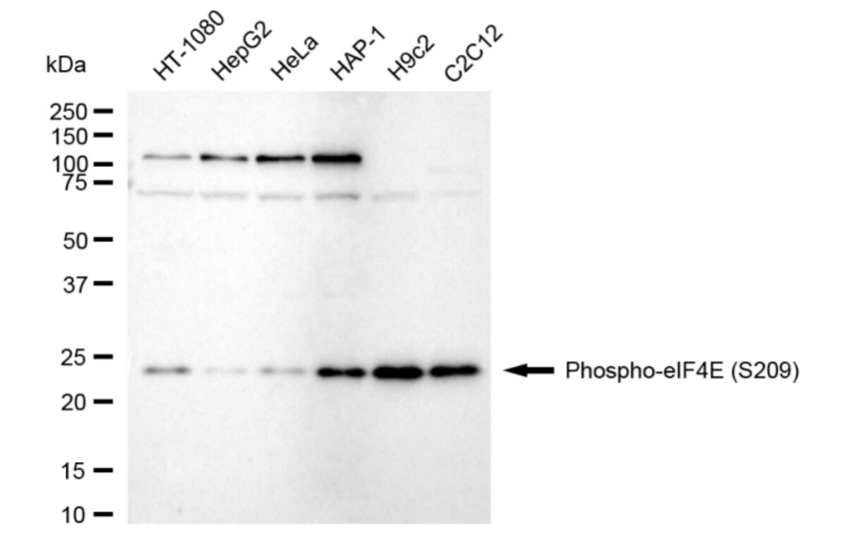 eIF4E [p Ser209] Antibody (24GB3975)