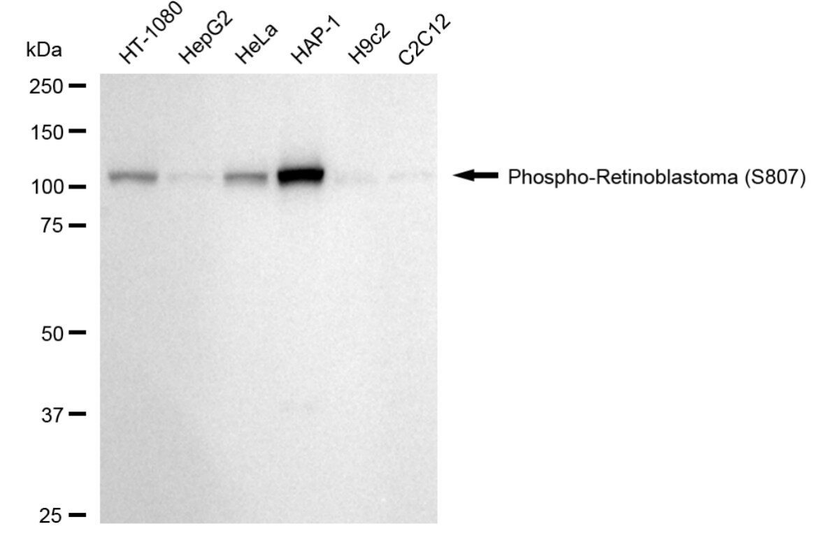 RB1 [p Ser807] Antibody (24GB3985)
