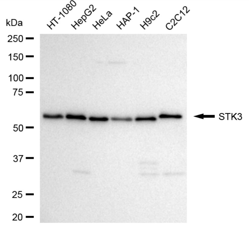 MST2/STK3 Antibody (24GB4010)