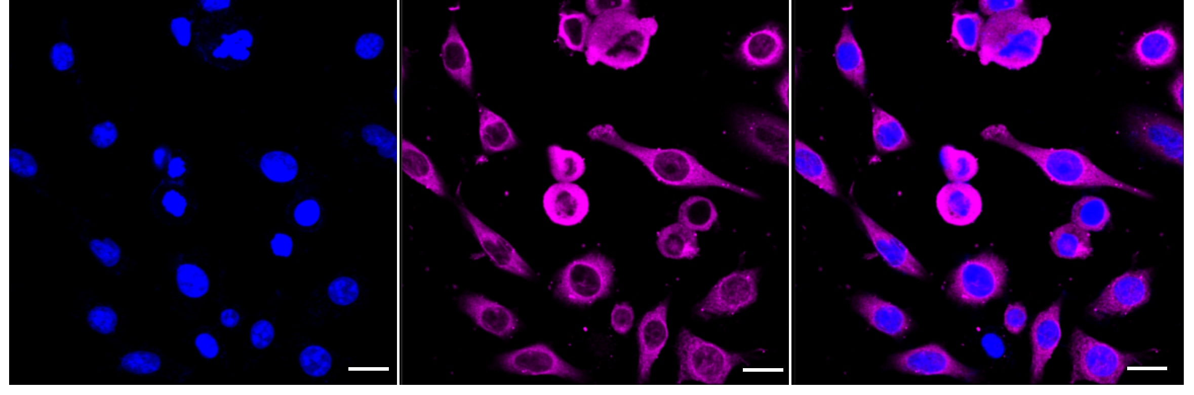 HSP27 [p Ser82] Antibody (24GB4015)
