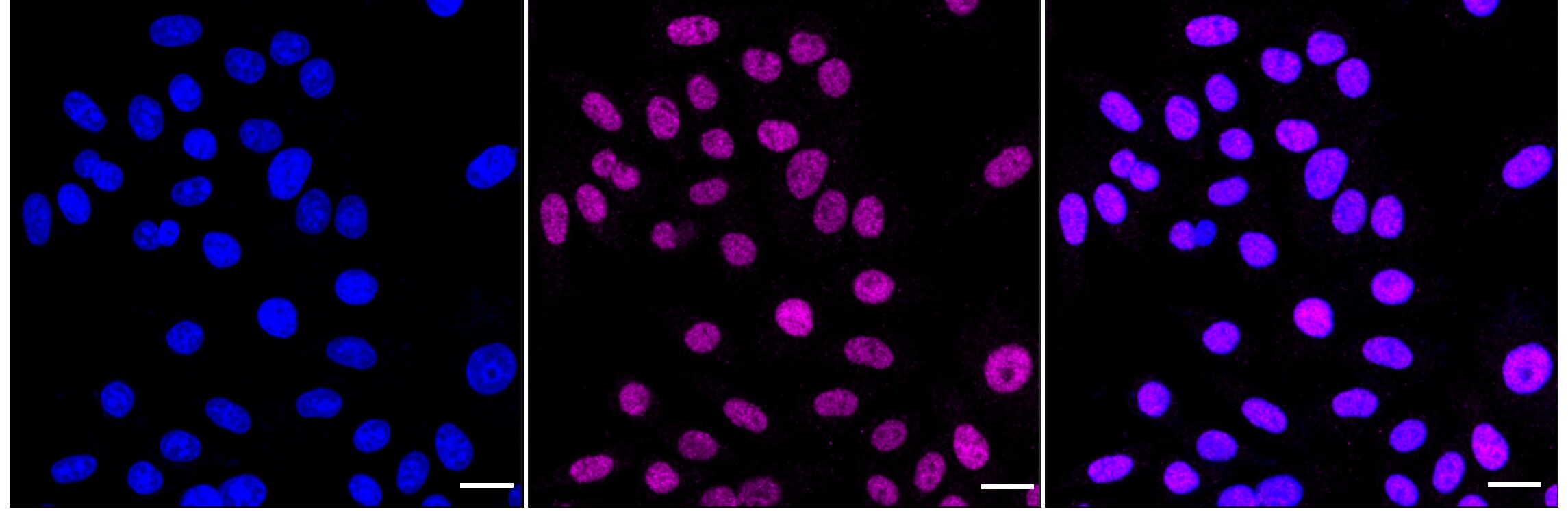 TCF7L2 Antibody (24GB4025)
