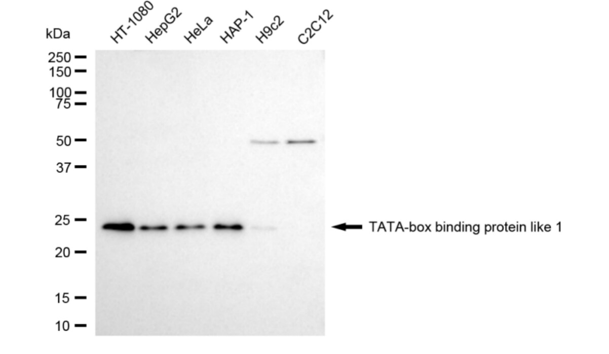 TBP like protein TLP Antibody (24GB4060)