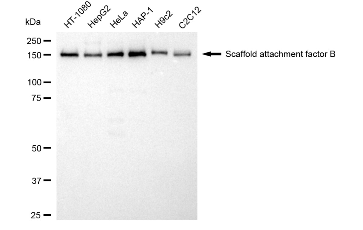 SAFB Antibody (24GB4110)