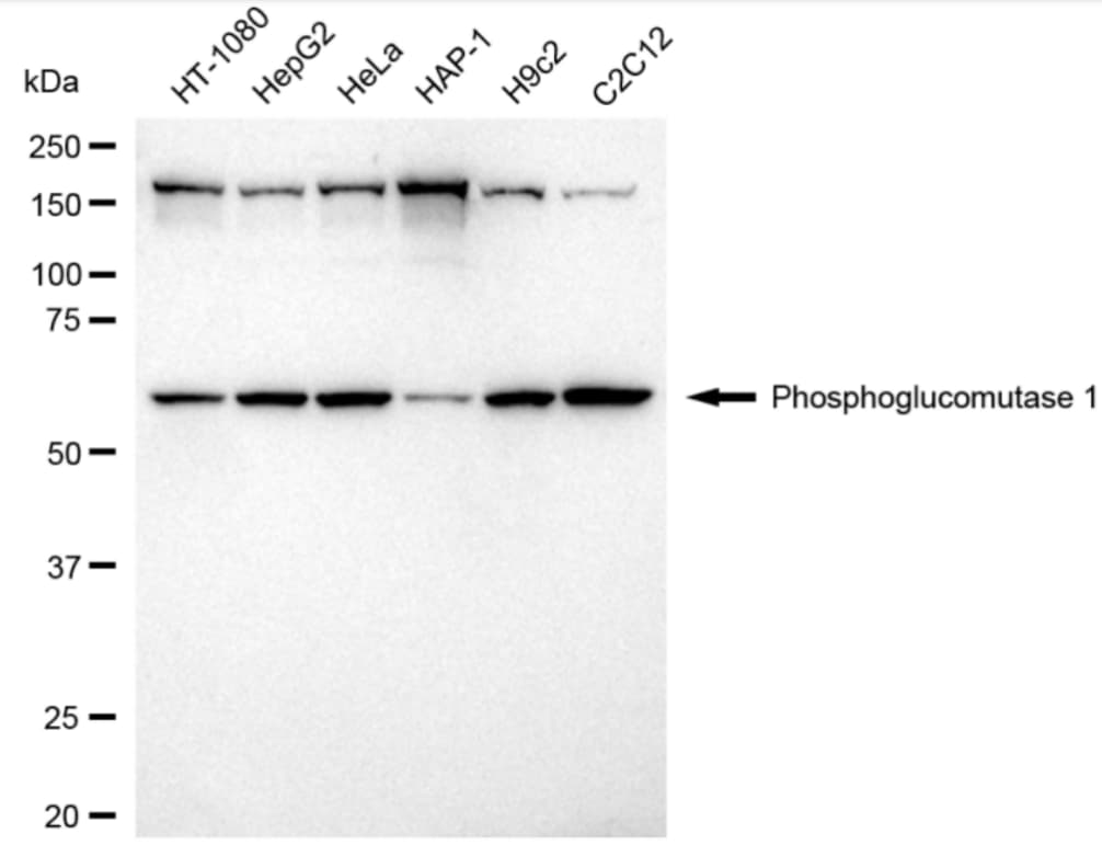 PGM1 Antibody (24GB4115)