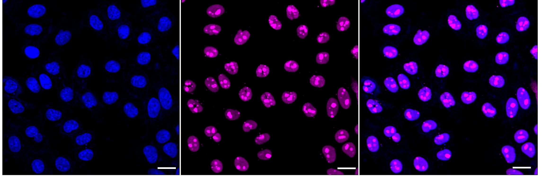 NPM1 [p Ser125] Antibody (24GB4180)