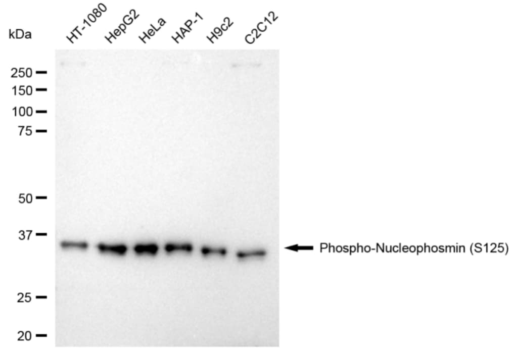 NPM1 [p Ser125] Antibody (24GB4180)