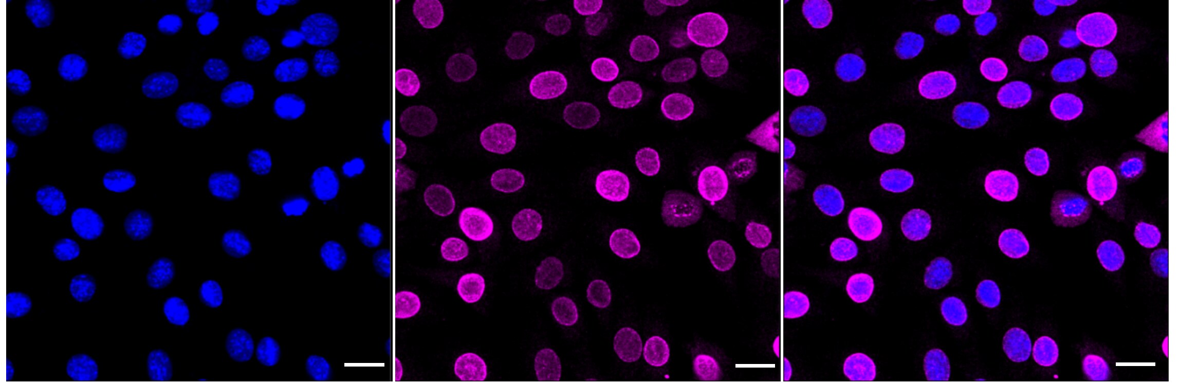 UNC84B Antibody (24GB4190)
