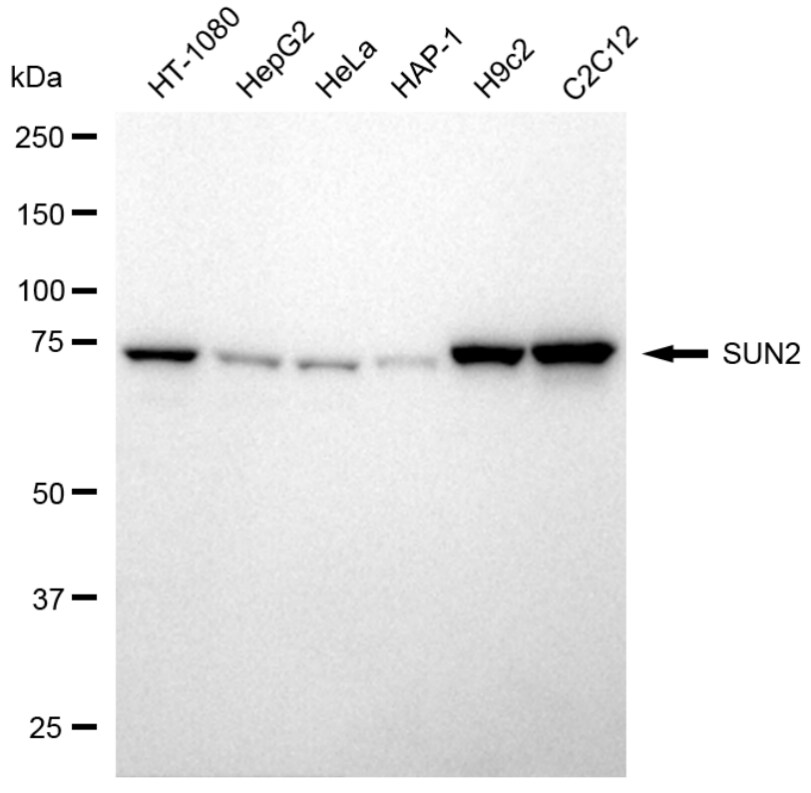 UNC84B Antibody (24GB4190)