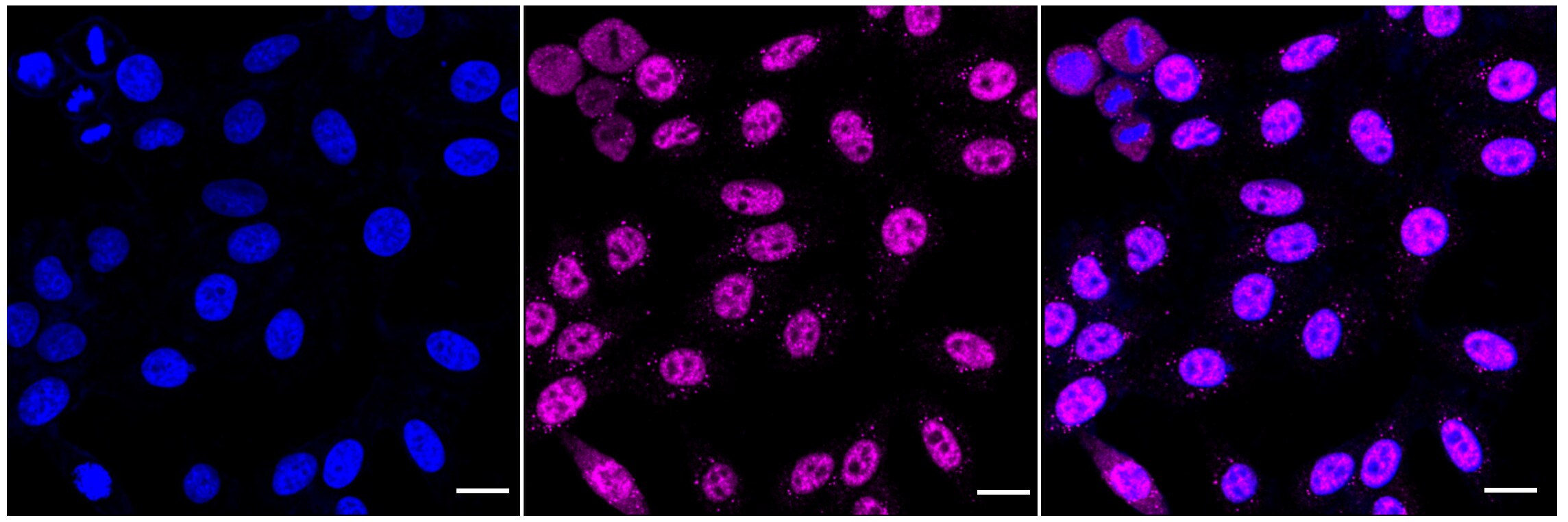 SART1 Antibody (24GB4210)