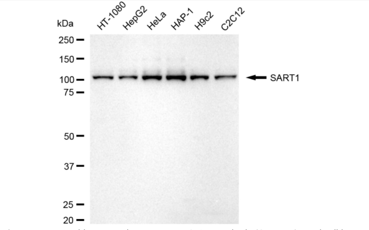 SART1 Antibody (24GB4210)