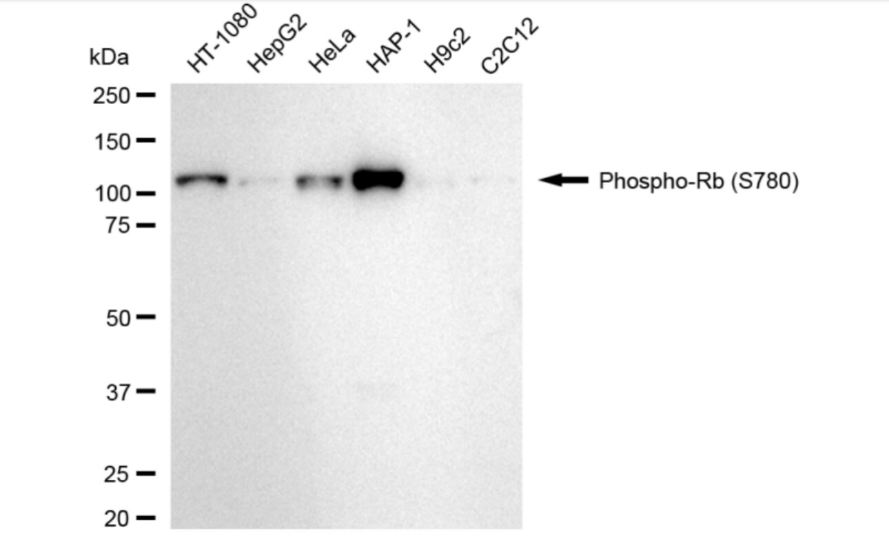 RB1 [p Ser780] Antibody (24GB4220)