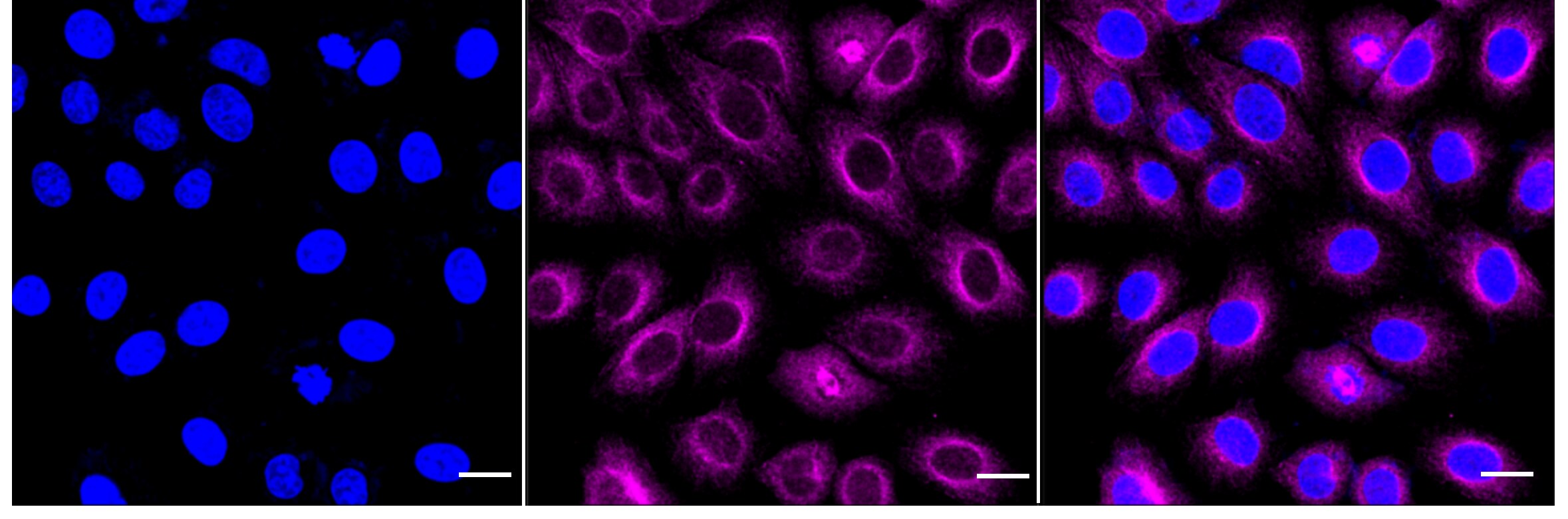 alcohol dehydrogenase 4 Antibody (24GB5120)