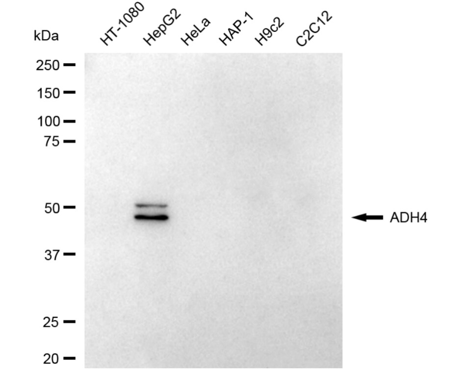 alcohol dehydrogenase 4 Antibody (24GB5120)