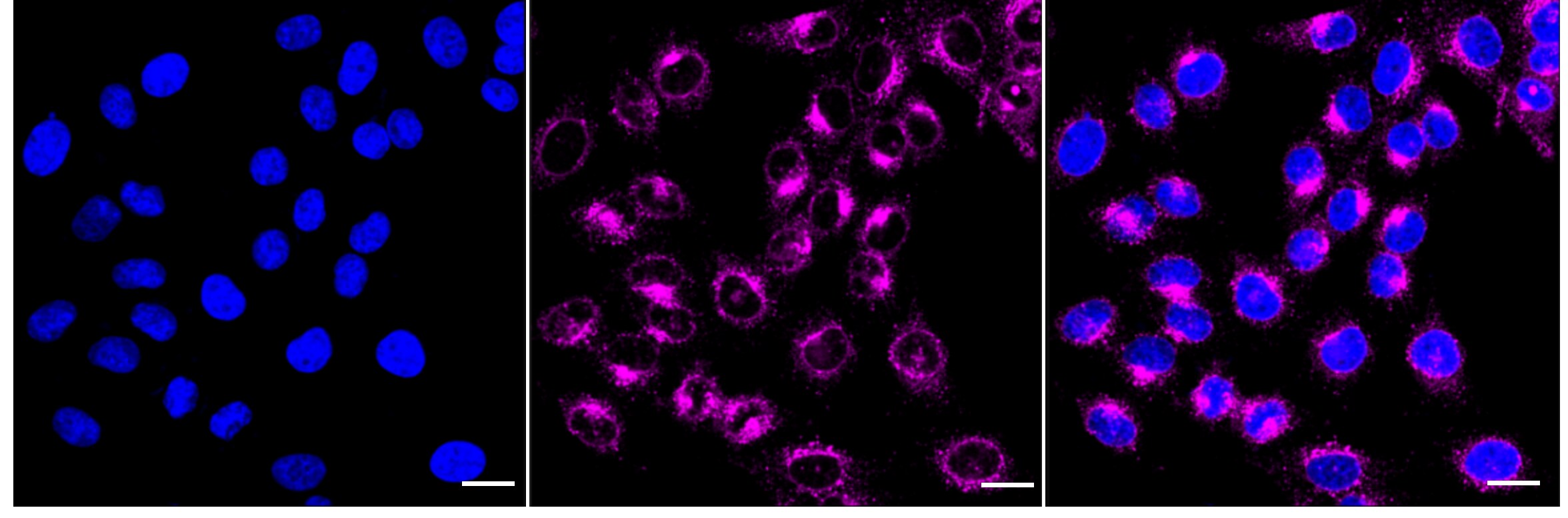 IFITM3/Fragilis Antibody (24GB5155)