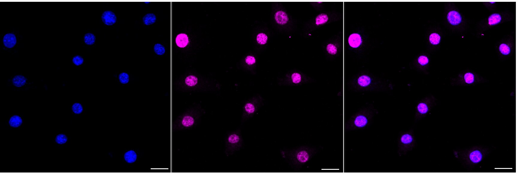 AKT1 [p Thr450] Antibody (24GB4255)