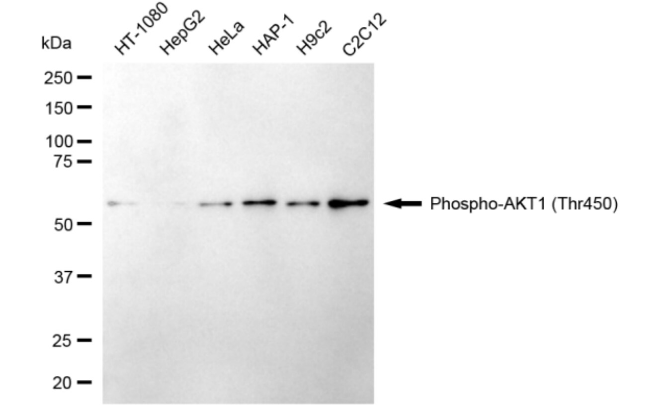 AKT1 [p Thr450] Antibody (24GB4255)