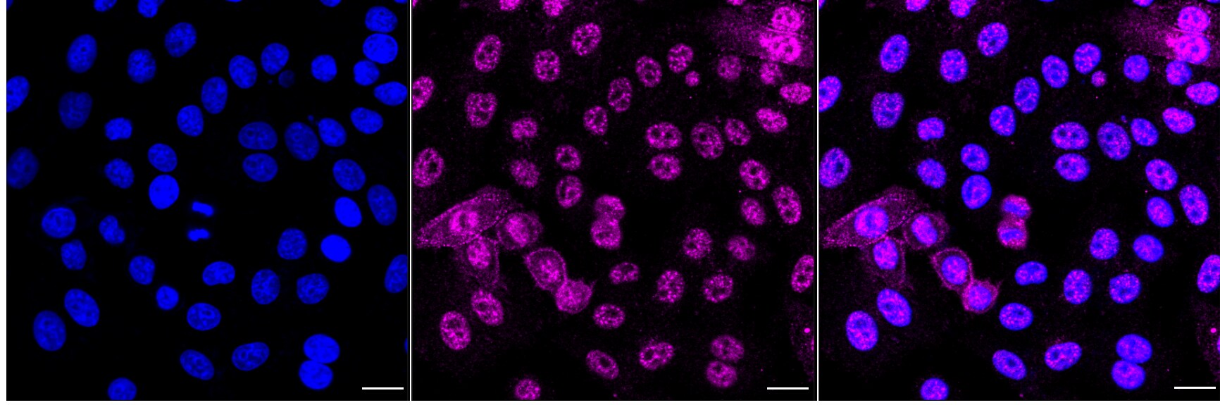 ErbB2/Her2 [p Tyr1248] Antibody (24GB4415)