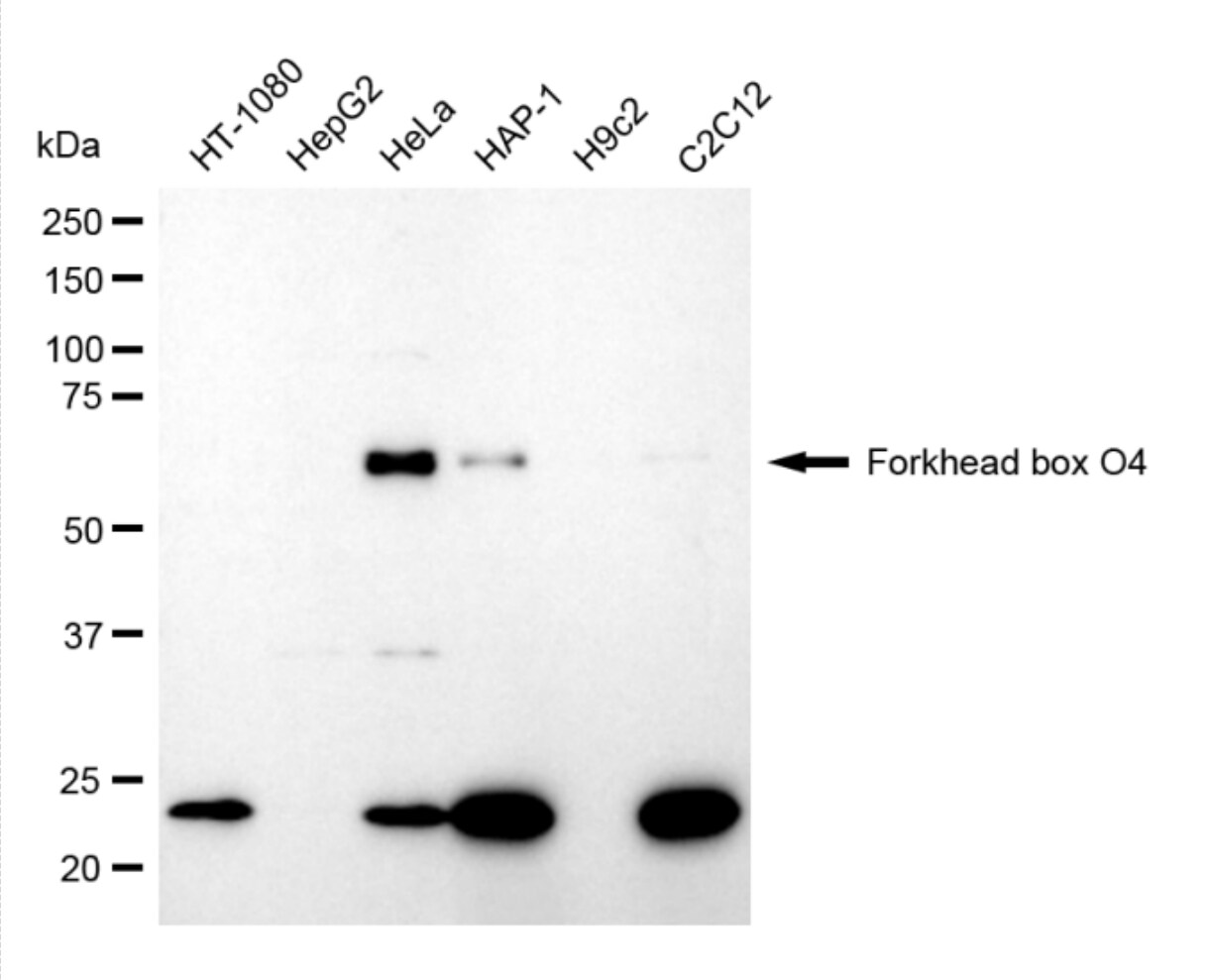 FOXO4 Antibody (24GB4440)