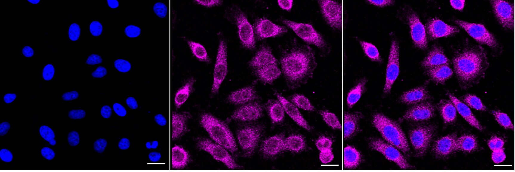 PKC gamma Antibody (24GB4495)