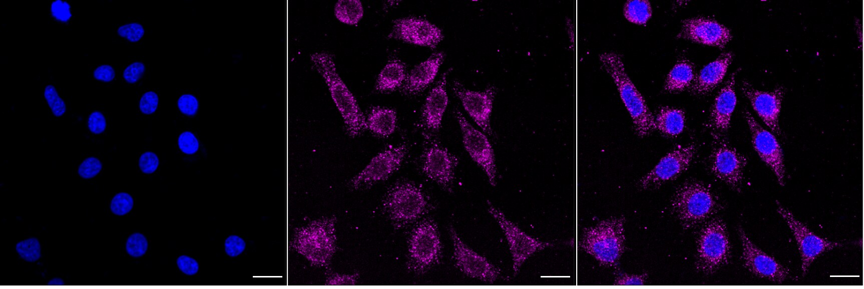 ROCK1 Antibody (24GB4530)