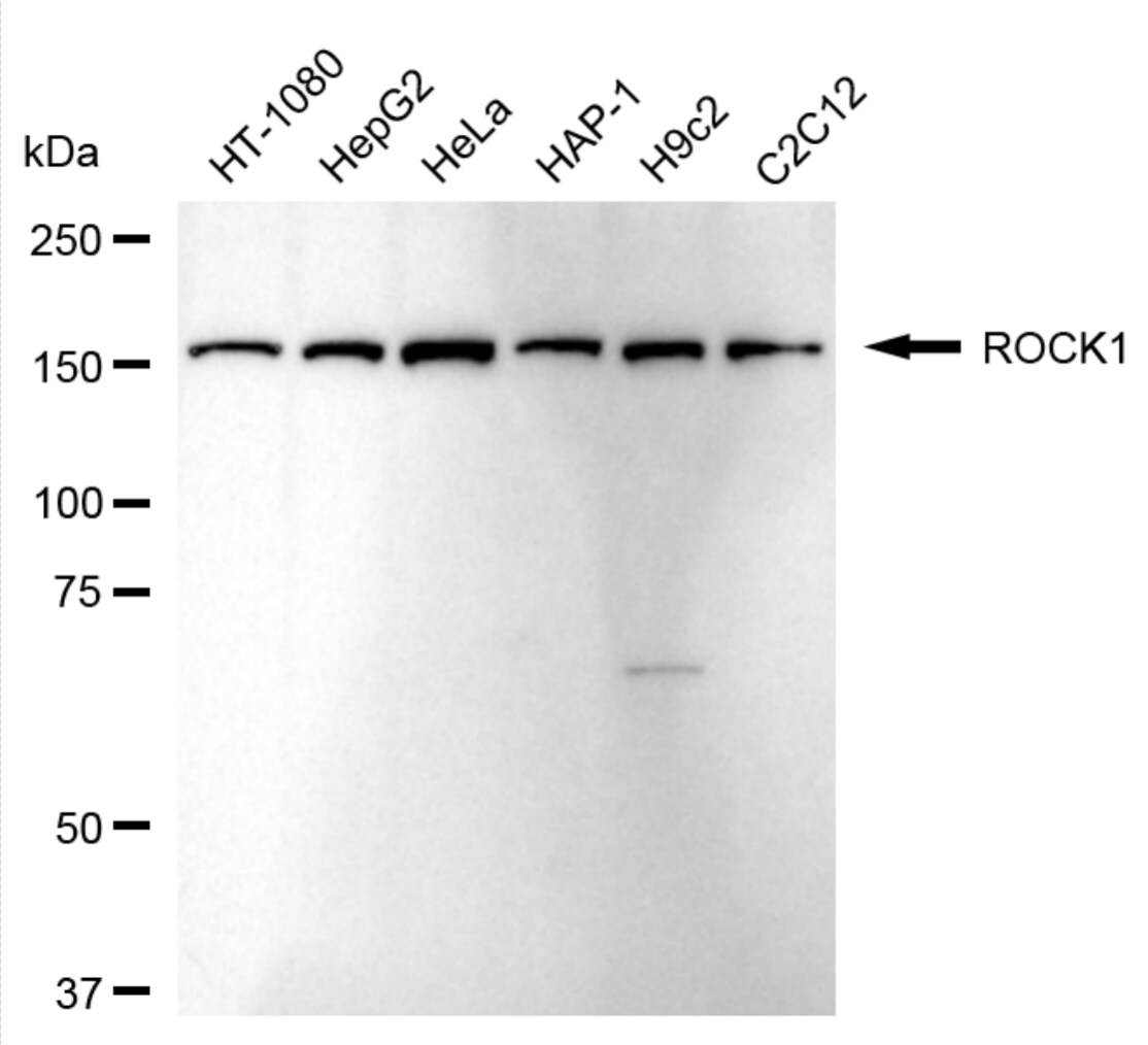 ROCK1 Antibody (24GB4530)
