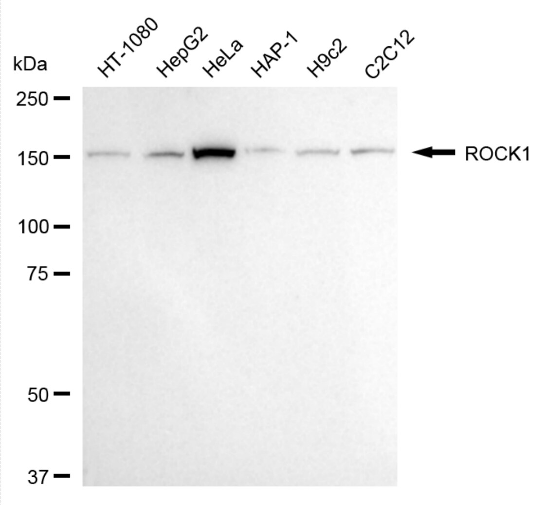 ROCK1 Antibody (24GB4535)