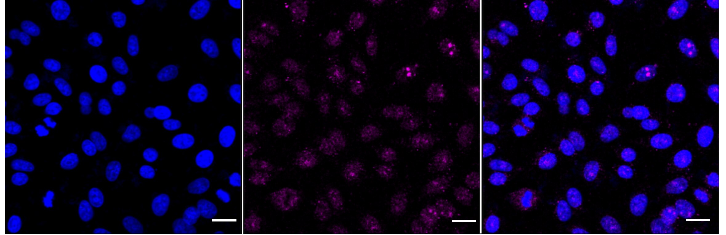 Activin RIIB Antibody (24GB4690)
