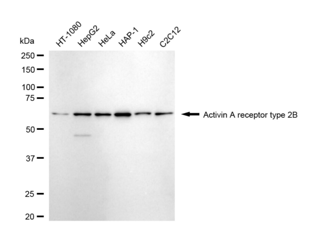 Activin RIIB Antibody (24GB4690)